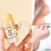Moist Hand Foot Cream For Rough Dry Skin Deeply Repairs Cracked Skin Moisturizes Ingredient Lanolin Protective Stick Hand Cream