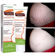 100g Stretch Marks Permanent Removal Cream Maternity Pregnant Women Pregnancy Anti-Winkle Smooth Repair Firming Skin Body Care