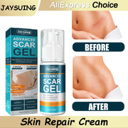 Skin Care Cream Scars Repair Gel Face Body Lotion Smoothing Hydrating Stretch Marks Cream Post Surgery Scar Care Gel Moisturize